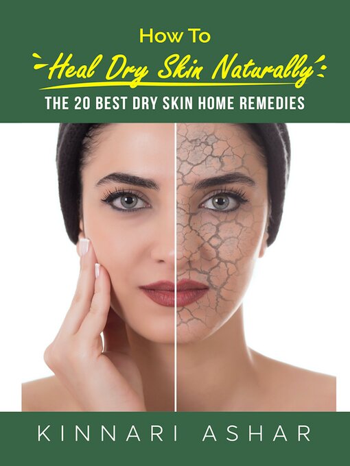 Title details for How to Heal Dry Skin Naturally by Kinnari Ashar - Wait list